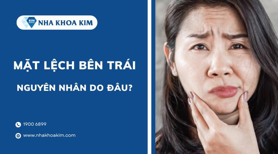 Nguyên nhân làm mặt lệch bên trái