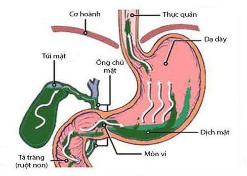 Vị trí túi mật