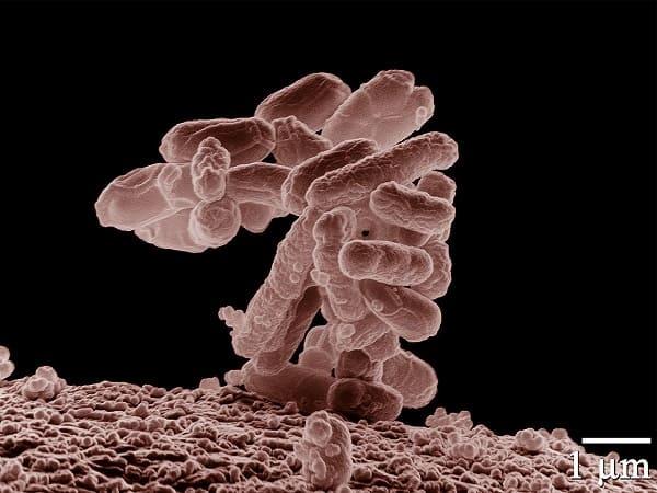 Vi sinh vật (microorganism) là gì?